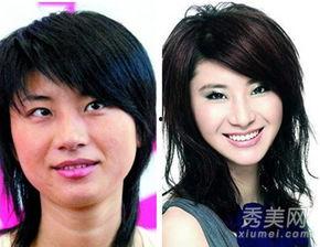 垫下巴的女明星,美丽与争议并存